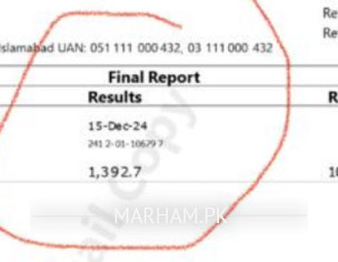 High Ferritin Level