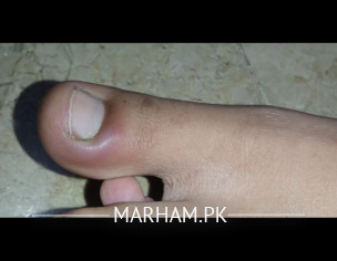 Skin Problem