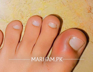 Skin Problem