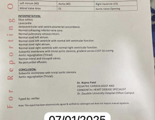 Aortic Stenosis