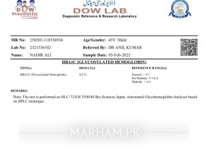 Glucose In Urine