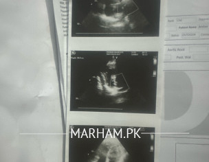 Heart Issue