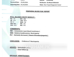 Aplastic Anemia