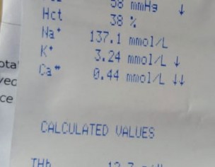 Difficulty In Breathing, When Walk Oxygen Level Decrease To 60%