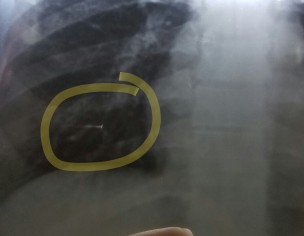 Xray Report