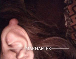 Flap On Ear