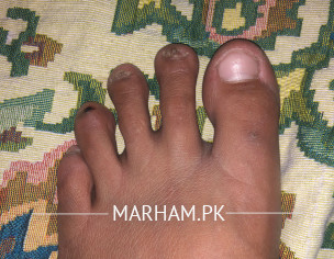 Nails And Fat