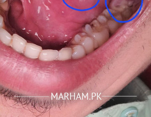 Oral Problem