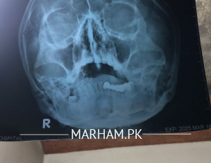 X Ray Report Check 