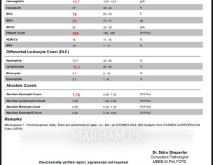 Iron Deficiency 