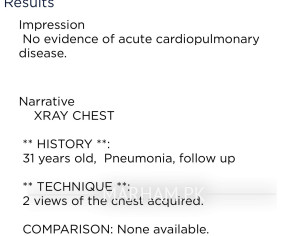 X Ray About Chest 