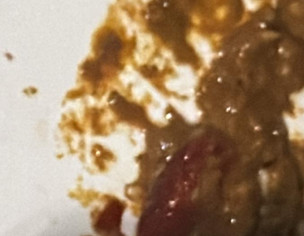 Blood In Stool