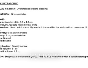 Endometrial Ployp