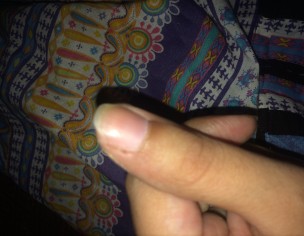 Skin Around Nails