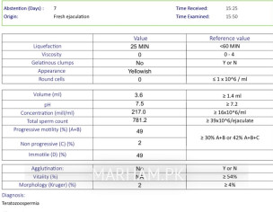 Sperm Analysis 