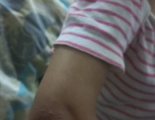 Skin Problem