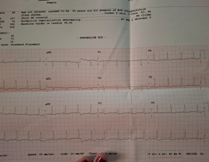 Heart Problem