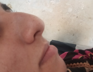 Nose Bone