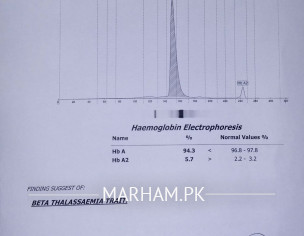 BETA THALASSAEMIA TRAIT.