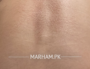 Flaky Dry Back Skin