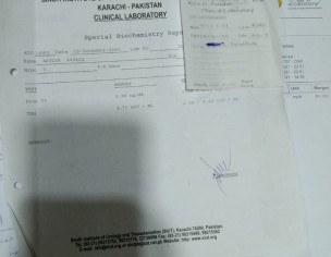 Hydronephrosis