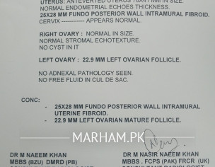 Eggs Issue