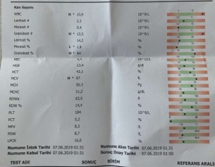 Report Reading 