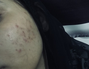 I Have Skin Problem