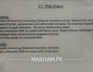 Sinusitis Problem