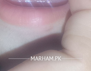 Teeth Problem
