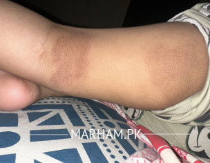 Skin Issue
