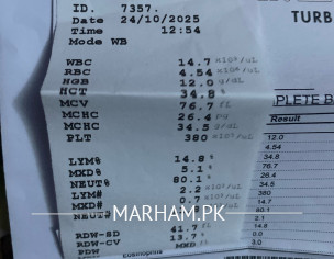 Left Breast Abscess