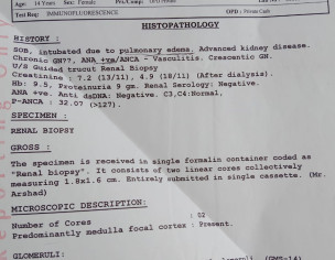 CKD, Lupus Nephritis