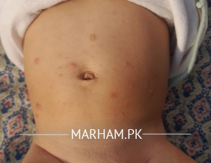 Skin Problem