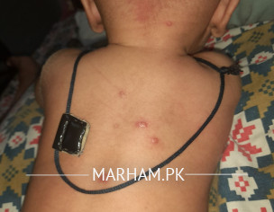 Skin Problems