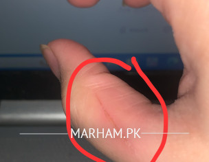 Deep Kitten Scratch