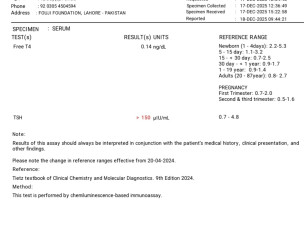 Congenial Hypothyroid