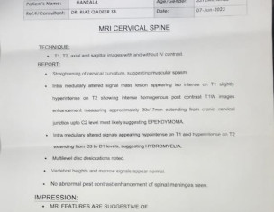 Tumor In Back