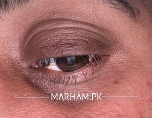 Dark Circle