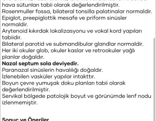 TRIGEMINAL NEURALGIA