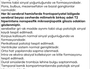 TRIGEMINAL NEURALGIA