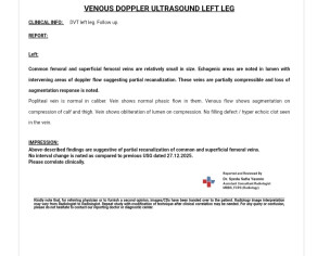Dvt After Csection