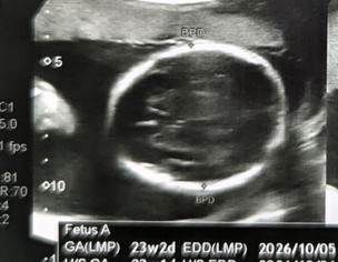 Gender From Ultrasound