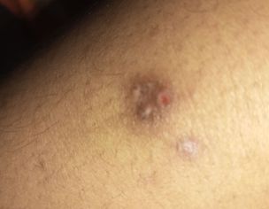Skin Issue
