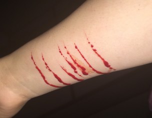 Depression 