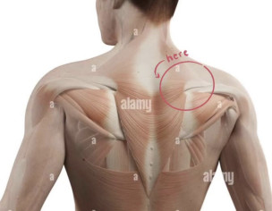 Back Ache