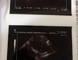 Conceiving 