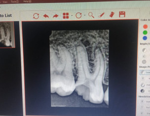 Dental Problem