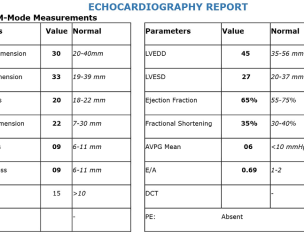 Echo Report