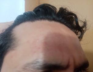 Skin Issues